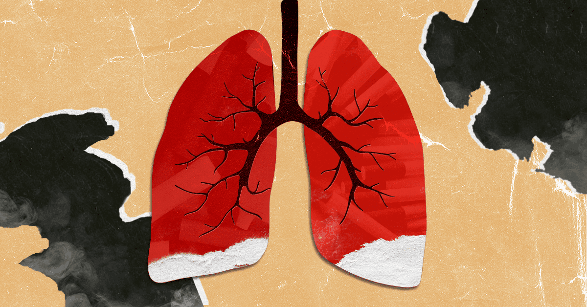 335241-TSET-TSWM-Short-Term-Effects-of-Tobacco-Use-SEO-Blog-02-F