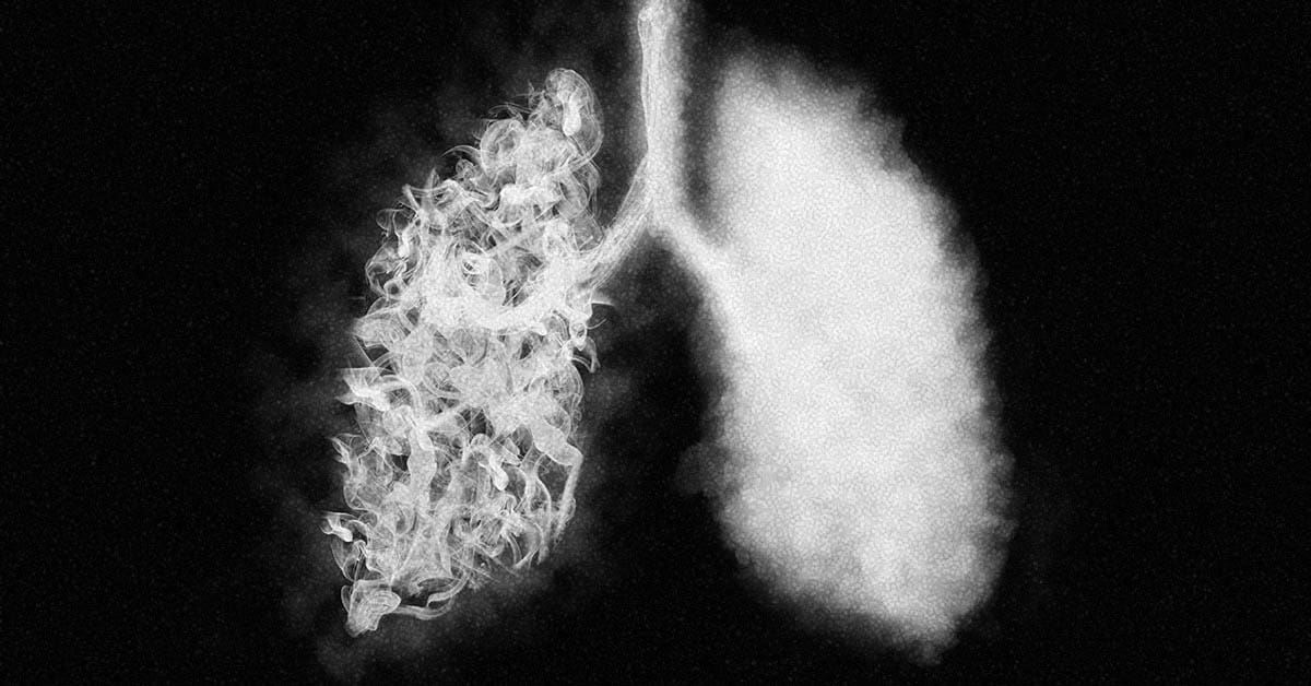 Health side effects of vaping vs smoking